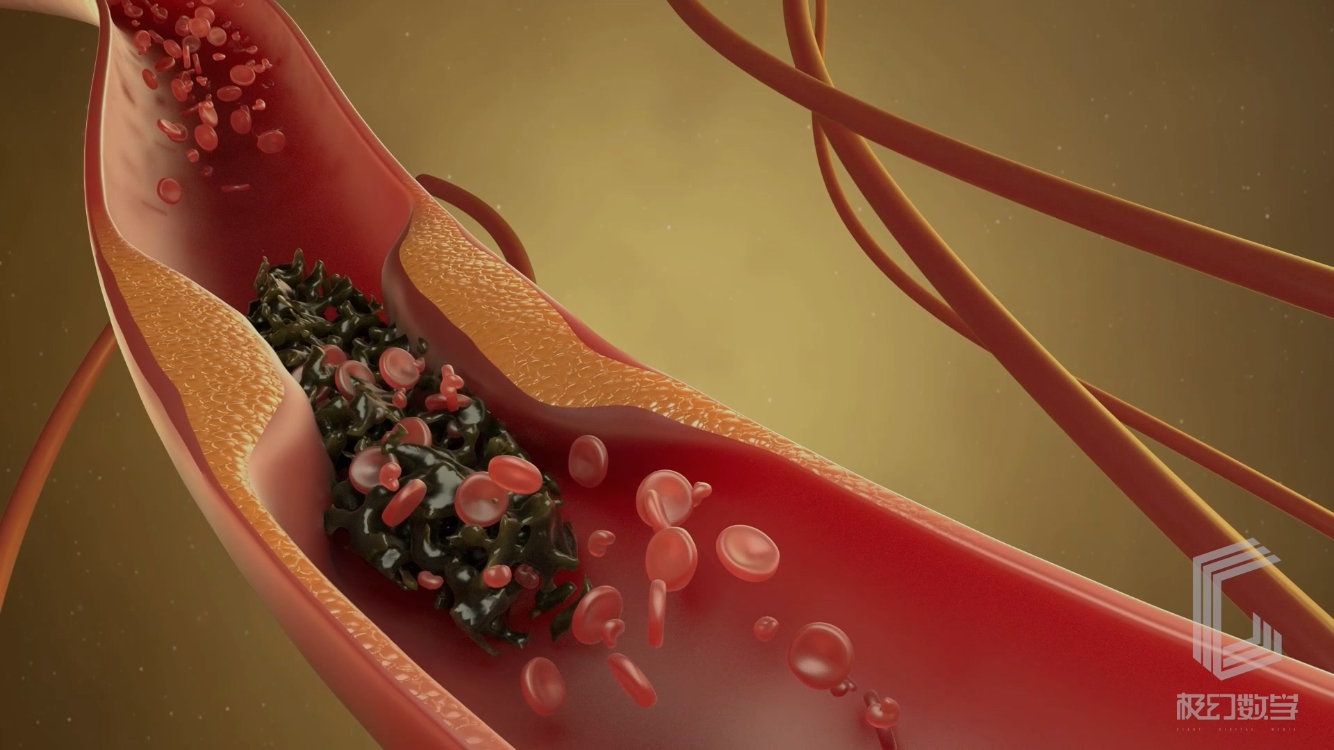 血管堵塞医学药理动画演绎