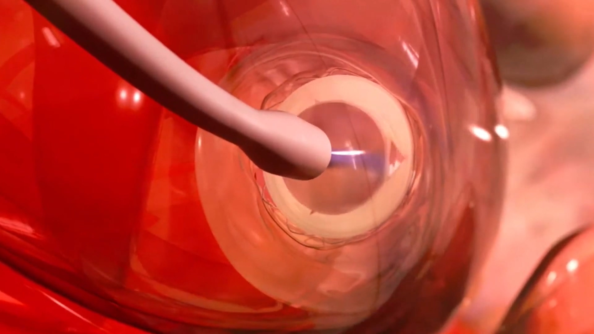 心脏搭桥动画演绎